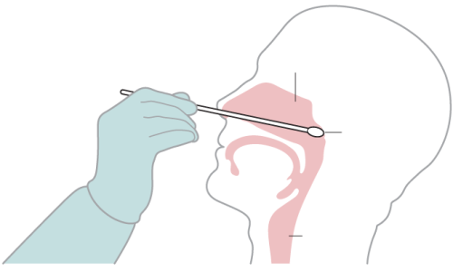 TOMA DE MUESTRAS DE HISOPADO NASOFARINGEO
